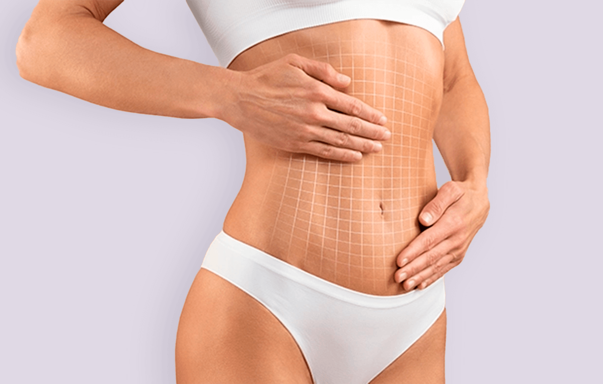 Manejo de fibrosis post lipo mediante drenaje linfático manual